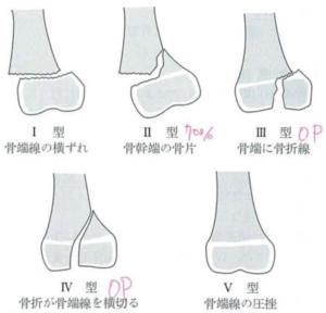 epiphyseal_injury_sh_ks-2016-11-30-21_53_07